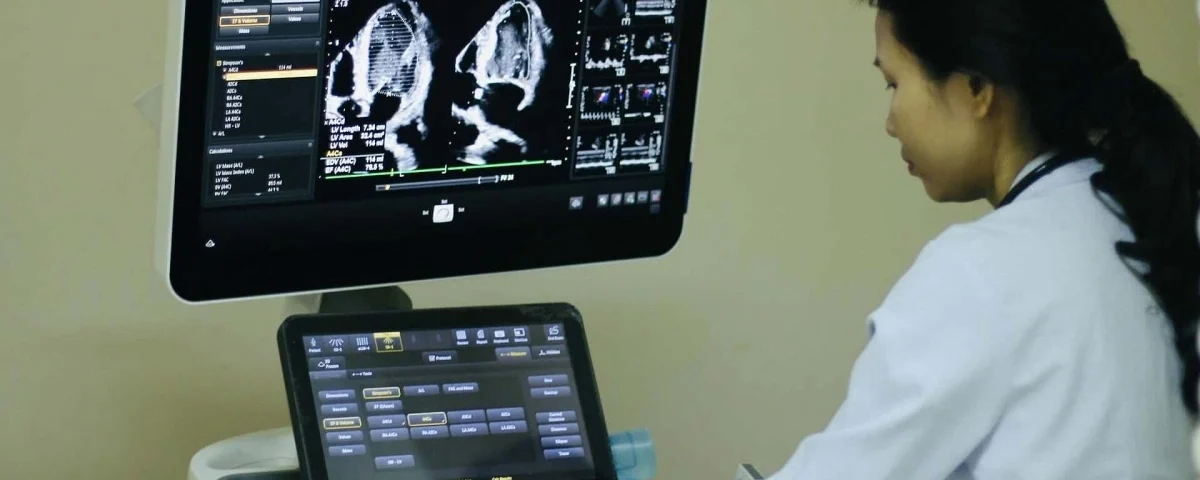 Ảnh trong bài viết: Suy tim Suy tim