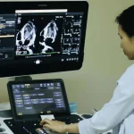 Ảnh trong bài viết: Suy tim Suy tim